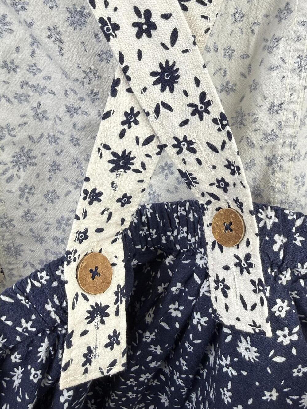 Free People Navy and White Palm Bay Printed 3" Shortails - Size - Small - NWOT - Picture 4 of 9